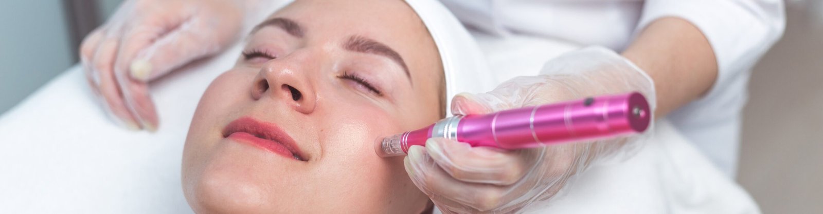 Brampton’s Trusted Derma Laser Clinic