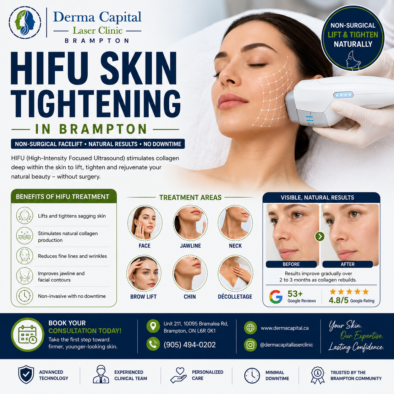 HIFU Skin Tightening in Brampton: Non-Surgical Facelift Benefits & Results