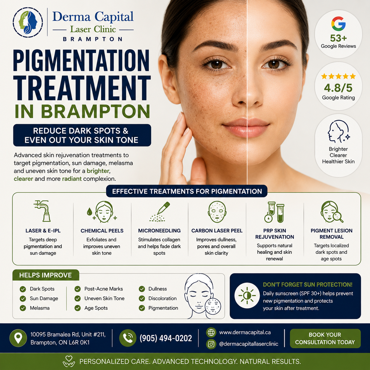 Pigmentation Treatment in Brampton: How to Reduce Dark Spots & Uneven Skin Tone
