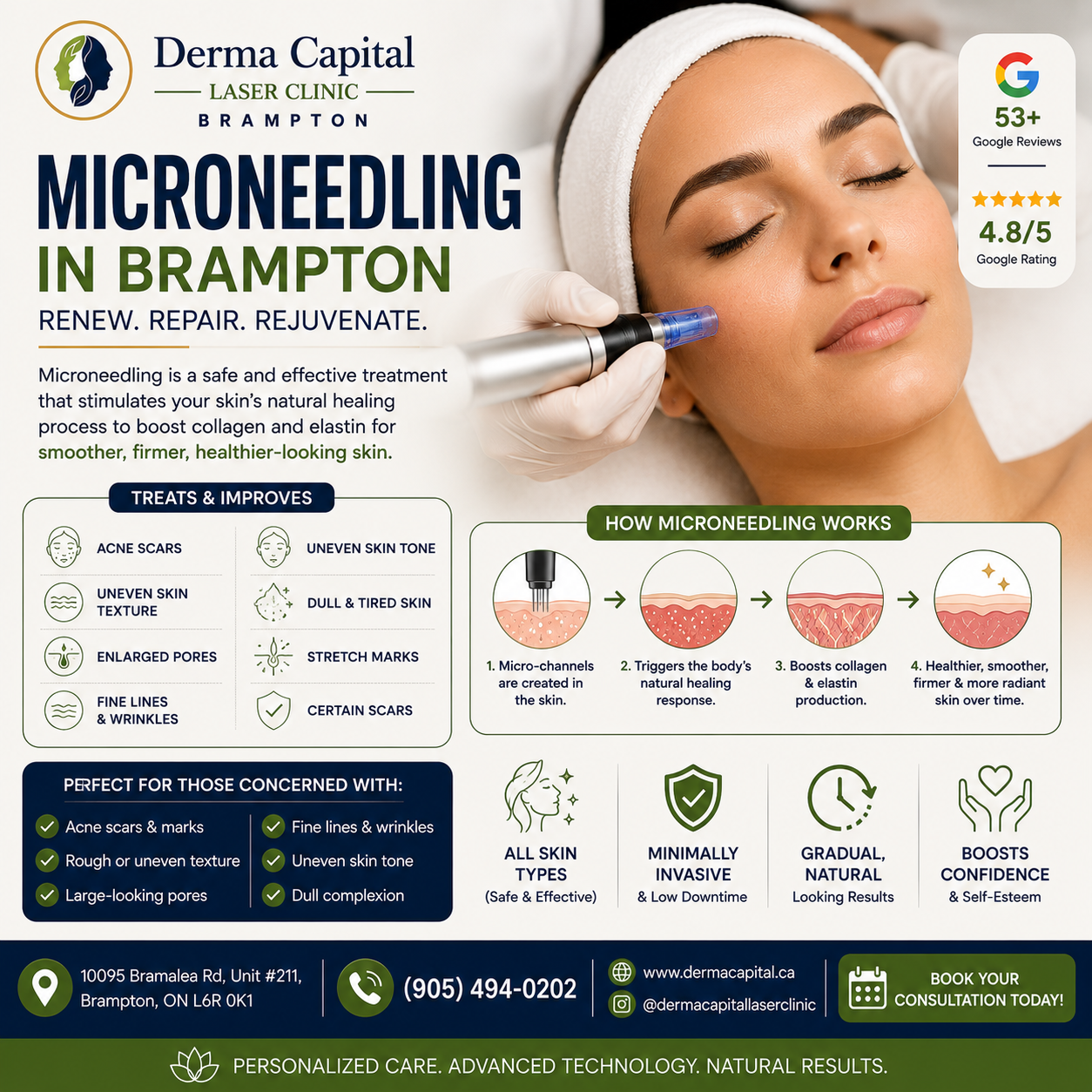 Microneedling in Brampton: Benefits, Results & What to Expect