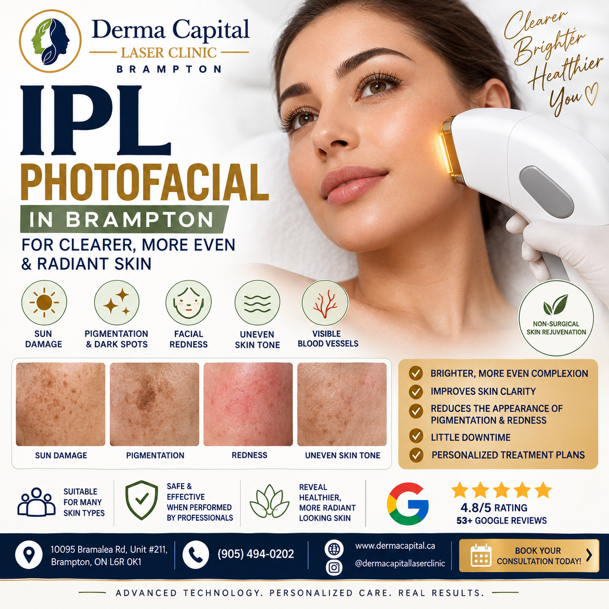 IPL Photofacial in Brampton: Benefits, Cost, Results & What to Expect