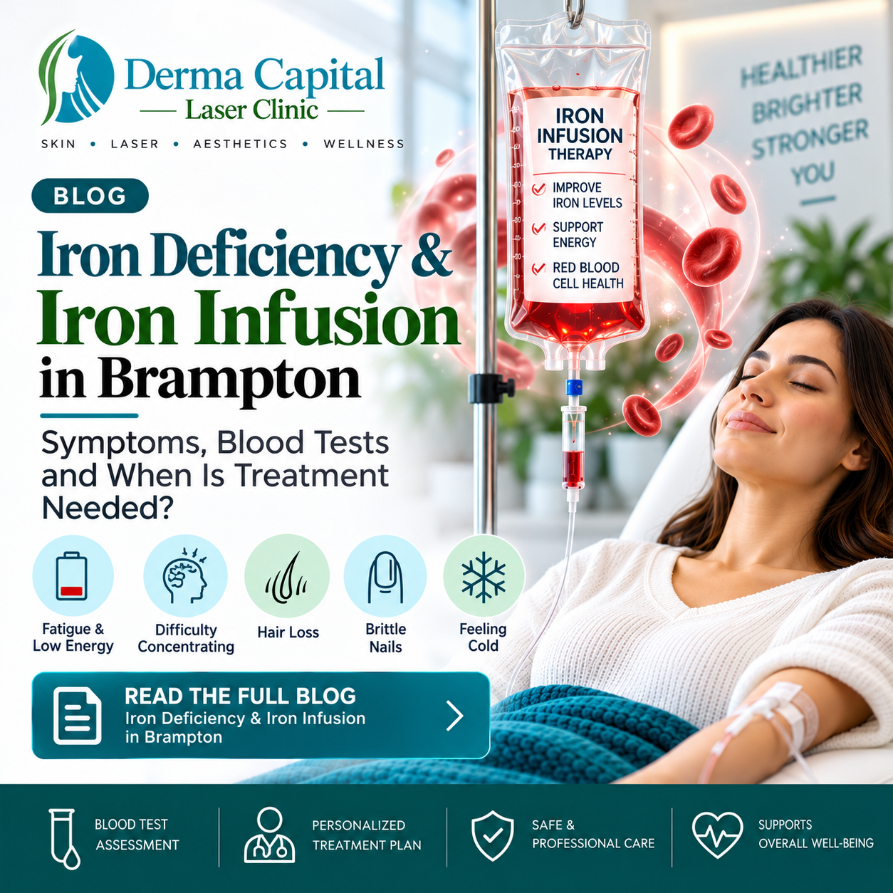 Iron Deficiency & Iron Infusion in Brampton: Symptoms and Treatment