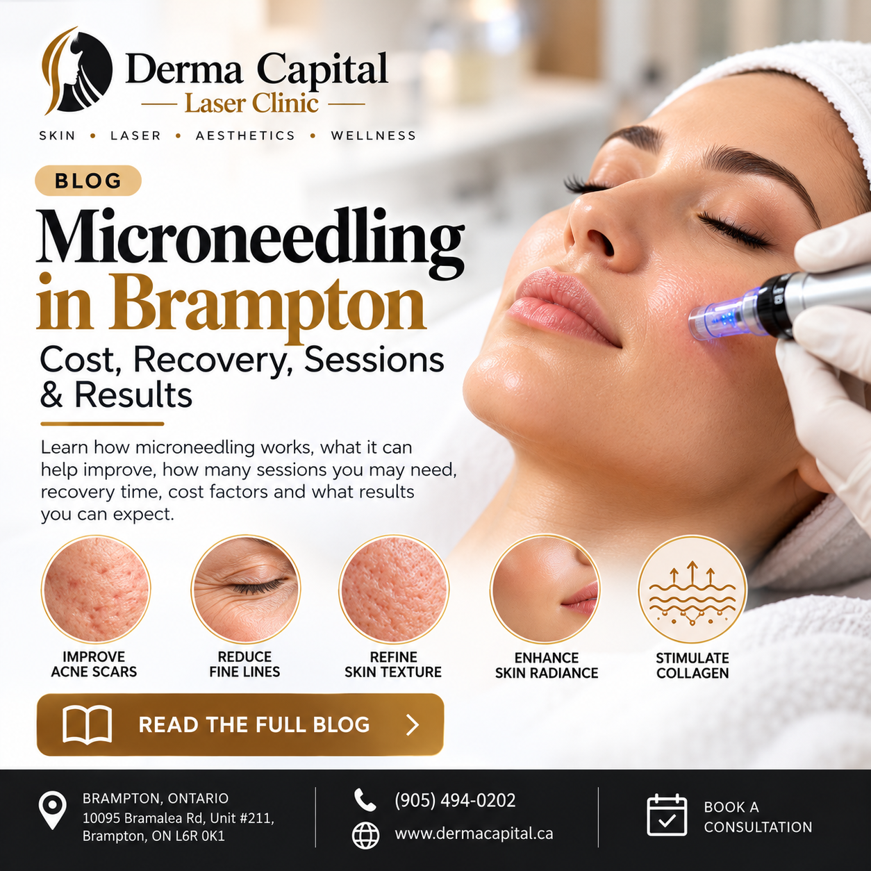 Microneedling in Brampton: Cost, Recovery, Sessions & Results